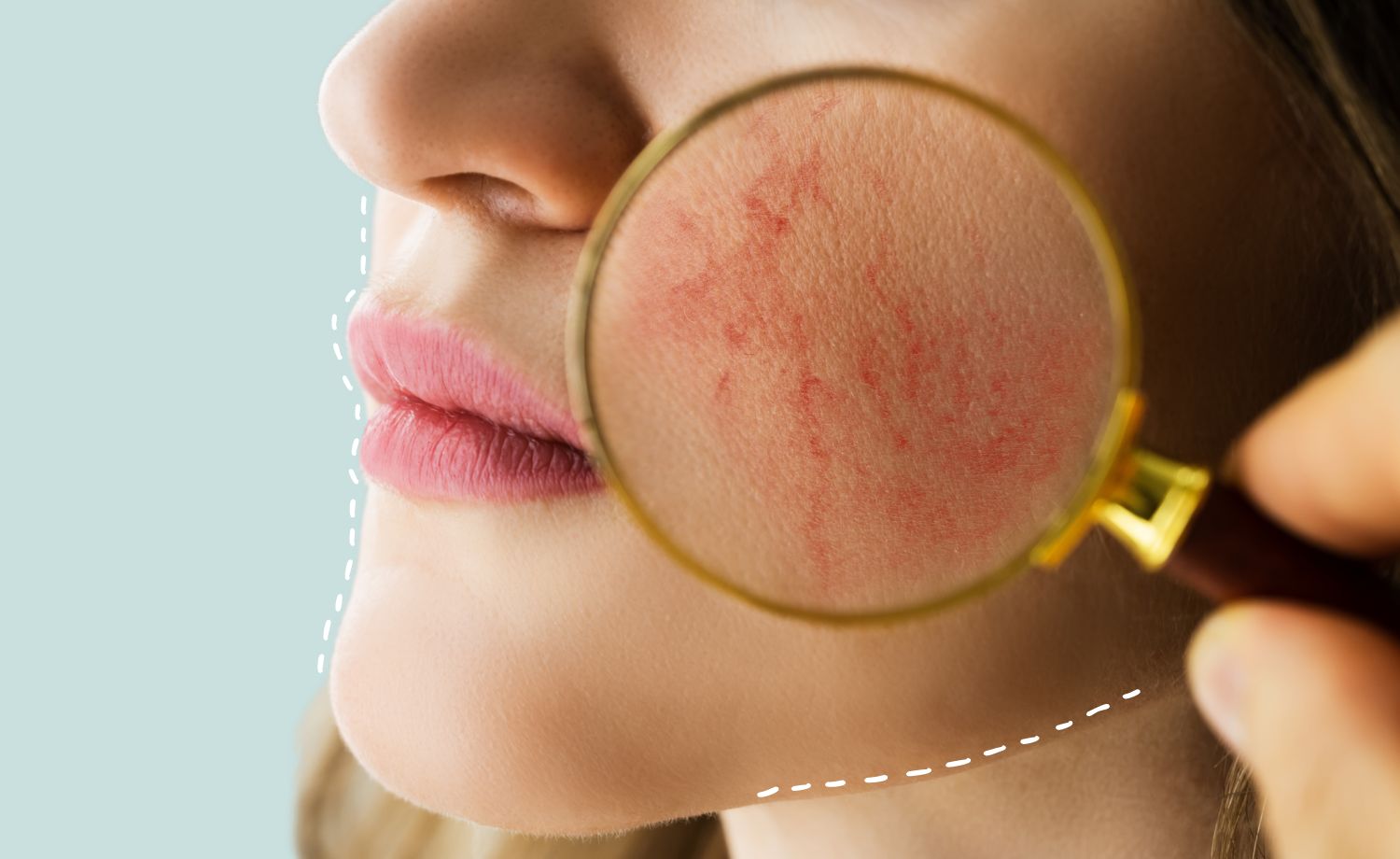 Consulta dermatológica